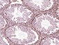 HSP70 Mouse mAb